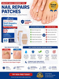 60PCS Anti Fungal Nail Treatment Patches – Toenail Fungus Repair Care for Onyc